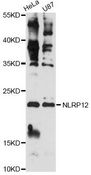 CSH1 / Placental Lactogen Antibody - Western blot analysis of extracts of various cell lines, using CSH1 antibody at 1:3000 dilution. The secondary antibody used was an HRP Goat Anti-Rabbit IgG (H+L) at 1:10000 dilution. Lysates were loaded 25ug per lane and 3% nonfat dry milk in TBST was used for blocking. An ECL Kit was used for detection and the exposure time was 90s.