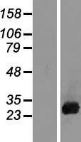 CSH1 / Placental Lactogen Protein - Western validation with an anti-DDK antibody * L: Control HEK293 lysate R: Over-expression lysate