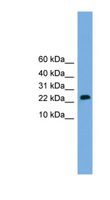 CSH2 / Placental Lactogen Antibody - CSH2 antibody Western blot of Placenta lysate. This image was taken for the unconjugated form of this product. Other forms have not been tested.