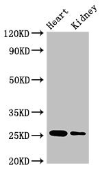 CSH2 / Placental Lactogen Antibody - Western Blot Positive WB detected in:Mouse heart tissue,Mouse kidney tissue All Lanes:CSH2 antibody at 4µg/ml Secondary Goat polyclonal to rabbit IgG at 1/50000 dilution Predicted band size: 25,19,14 KDa Observed band size: 25 KDa