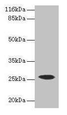 CSHL1 / CSH-Like 1 Antibody - Western blot All lanes: CSHL1 antibody at 2µg/ml + Mouse placenta tissue Secondary Goat polyclonal to rabbit IgG at 1/10000 dilution Predicted band size: 26, 23, 16, 15 kDa Observed band size: 26 kDa