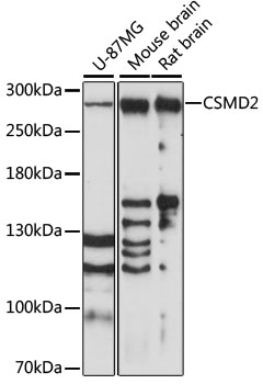 CSMD2 Antibody - Western blot analysis of extracts of various cell lines, using CSMD2 antibody at 1:1000 dilution. The secondary antibody used was an HRP Goat Anti-Rabbit IgG (H+L) at 1:10000 dilution. Lysates were loaded 25ug per lane and 3% nonfat dry milk in TBST was used for blocking. An ECL Kit was used for detection and the exposure time was 90s.