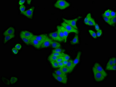 CSMD3 Antibody - Immunofluorescence staining of HepG2 cells at a dilution of 1:133, counter-stained with DAPI. The cells were fixed in 4% formaldehyde, permeabilized using 0.2% Triton X-100 and blocked in 10% normal Goat Serum. The cells were then incubated with the antibody overnight at 4 °C.The secondary antibody was Alexa Fluor 488-congugated AffiniPure Goat Anti-Rabbit IgG (H+L) .