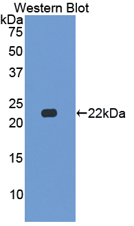 CSN2 / Beta Casein Antibody - Western blot of CSN2 / Beta Casein antibody.