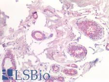 CSN2 / Beta Casein Antibody - Human Breast: Formalin-Fixed, Paraffin-Embedded (FFPE)