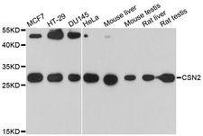 CSN2 / Beta Casein Antibody - Western blot analysis of extracts of various cell lines, using CSN2 antibody at 1:3000 dilution. The secondary antibody used was an HRP Goat Anti-Rabbit IgG (H+L) at 1:10000 dilution. Lysates were loaded 25ug per lane and 3% nonfat dry milk in TBST was used for blocking. An ECL Kit was used for detection and the exposure time was 90s.