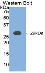 CSNK1A1 / CK1 Alpha Antibody - Western blot of recombinant CSNK1A1 / CK1 Alpha.  This image was taken for the unconjugated form of this product. Other forms have not been tested.