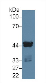 CSNK1A1 / CK1 Alpha Antibody - Western Blot; Sample: Human MCF7 cell lysate; Primary Ab: 2µg/ml Rabbit Anti-Rat CSNK1a1 Antibody Second Ab: 0.2µg/mL HRP-Linked Caprine Anti-Rabbit IgG Polyclonal Antibody