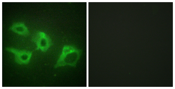 CSNK1A1 / CK1 Alpha Antibody - Immunofluorescence analysis of HeLa cells, using CKI-alpha Antibody. The picture on the right is blocked with the synthesized peptide.