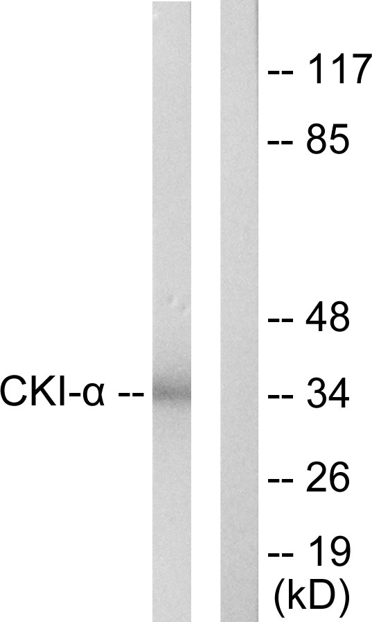 CSNK1A1 / CK1 Alpha Antibody - Western blot analysis of lysates from HeLa cells, using CKI-alpha Antibody. The lane on the right is blocked with the synthesized peptide.