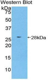 CSNK1A1 / CK1 Alpha Antibody - Western blot of recombinant CSNK1A1 / CK1 Alpha.  This image was taken for the unconjugated form of this product. Other forms have not been tested.