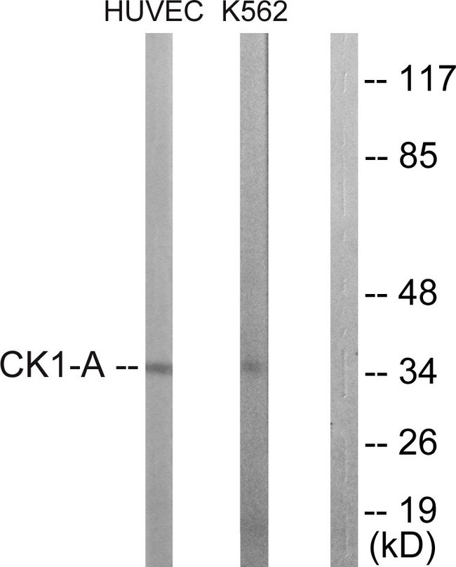 CSNK1A1 / CK1 Alpha Antibody - Western blot analysis of lysates from HUVEC and K562 cells, using CKI-alpha Antibody. The lane on the right is blocked with the synthesized peptide.