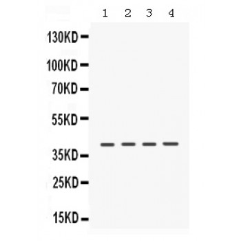 CSNK1A1 / CK1 Alpha Antibody - CSNK1A1 antibody Western blot. All lanes: Anti CSNK1A1 at 0.5 ug/ml. Lane 1: Rat Brain Tissue Lysate at 50 ug. Lane 2: Rat Kidney Tissue Lysate at 50 ug. Lane 3: Mouse Kidney Tissue Lysate at 50 ug. Lane 4: HELA Whole Cell Lysate at 40 ug. Predicted band size: 39 kD. Observed band size: 39 kD.