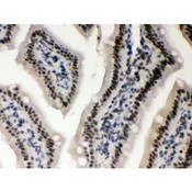 CSNK1A1 / CK1 Alpha Antibody - CSNK1A1 antibody IHC-paraffin. IHC(P): Mouse Intestine Tissue.