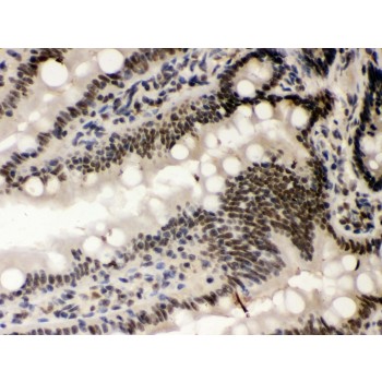 CSNK1A1 / CK1 Alpha Antibody - CSNK1A1 antibody IHC-paraffin. IHC(P): Rat Intestine Tissue.