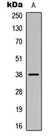 CSNK1A1 / CK1 Alpha Antibody - Western blot analysis of CK1 alpha (pY294) expression in Jurkat heat shock-treated (A) whole cell lysates.