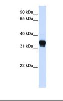 CSNK1A1 / CK1 Alpha Antibody - 293T cell lysate. Antibody concentration: 1.0 ug/ml. Gel concentration: 12%.  This image was taken for the unconjugated form of this product. Other forms have not been tested.
