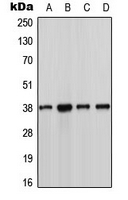 CSNK1A1 / CK1 Alpha Antibody - Western blot analysis of CK1 alpha expression in MCF7 (A); Jurkat (B); NIH3T3 (C); H9C2 (D) whole cell lysates.