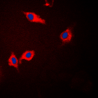 CSNK1A1 / CK1 Alpha Antibody - Immunofluorescent analysis of CK1 alpha staining in Jurkat cells. Formalin-fixed cells were permeabilized with 0.1% Triton X-100 in TBS for 5-10 minutes and blocked with 3% BSA-PBS for 30 minutes at room temperature. Cells were probed with the primary antibody in 3% BSA-PBS and incubated overnight at 4 C in a humidified chamber. Cells were washed with PBST and incubated with a DyLight 594-conjugated secondary antibody (red) in PBS at room temperature in the dark. DAPI was used to stain the cell nuclei (blue).