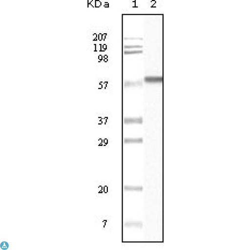 CSNK1A1 / CK1 Alpha Antibody - Immunohistochemistry (IHC) analysis of paraffin-embedded Human Liver Tissue (A), colon carcinoma (B), lung carcinoma (C) and esophagus tissue (D), showing membrane localization with DAB staining using Casein Kinase Ialpha Monoclonal Antibody.