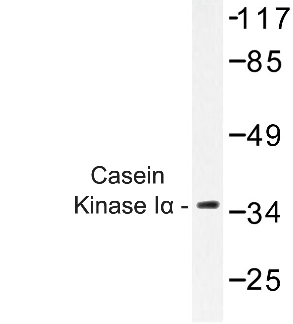 CSNK1A1 / CK1 Alpha Antibody - Western blot of Casein Kinase I (F158) pAb in extracts from HeLa cells.