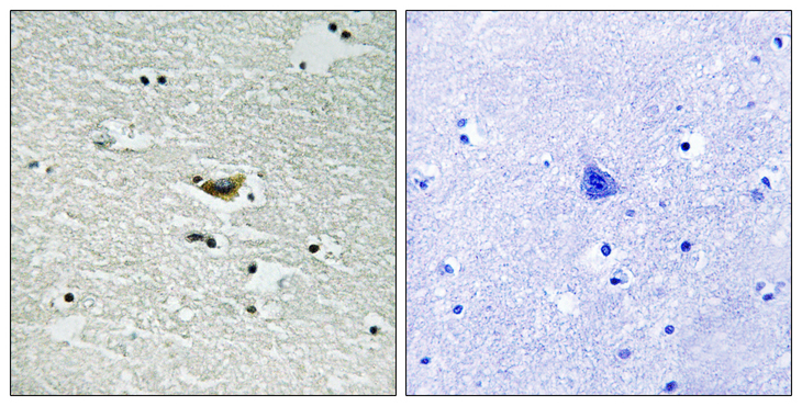 CSNK1A1 / CK1 Alpha Antibody - Immunohistochemistry analysis of paraffin-embedded human brain, using CK-1 alpha (Phospho-Tyr294) Antibody. The picture on the right is blocked with the phospho peptide.