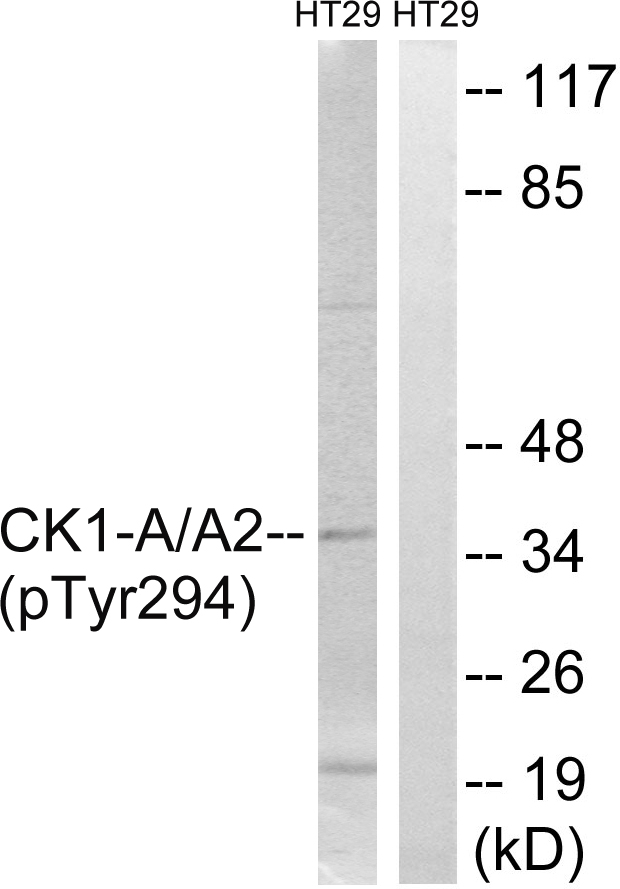 CSNK1A1 / CK1 Alpha Antibody - Western blot analysis of lysates from HT29 cells treated with heat shock, using CK-1 alpha (Phospho-Tyr294) Antibody. The lane on the right is blocked with the phospho peptide.
