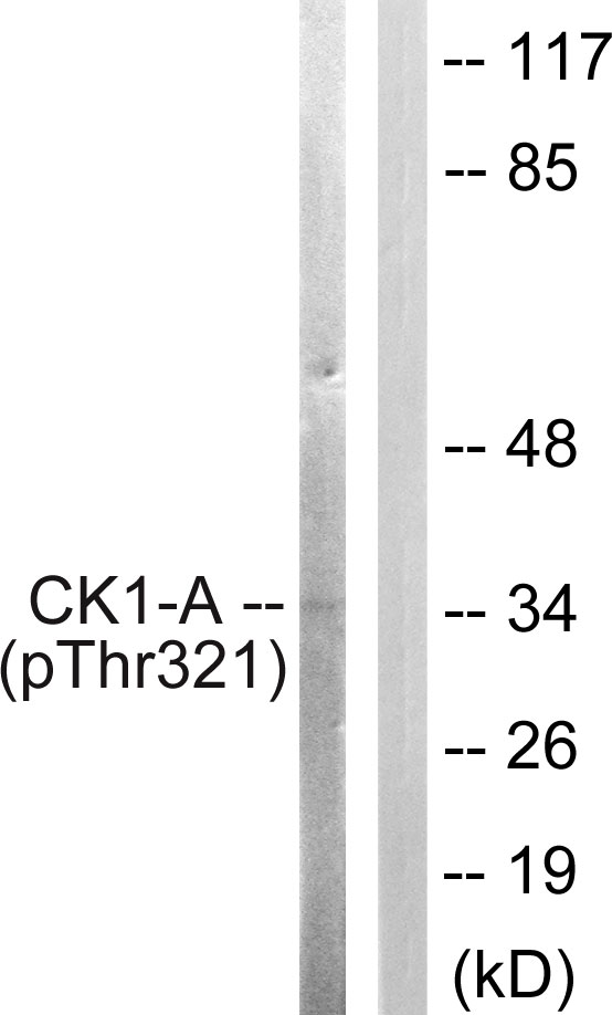 CSNK1A1 / CK1 Alpha Antibody - Western blot analysis of lysates from HUVEC cells, using Casein Kinase I alpha (Phospho-Tyr321) Antibody. The lane on the right is blocked with the phospho peptide.