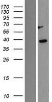 CSNK1A1 / CK1 Alpha Protein - Western validation with an anti-DDK antibody * L: Control HEK293 lysate R: Over-expression lysate