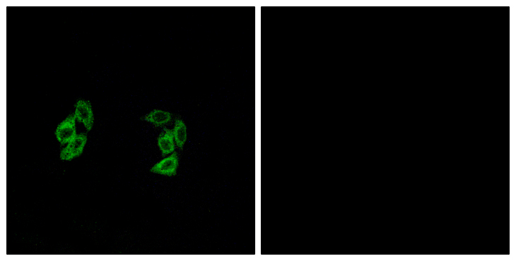 CSNK1A1 + CSNK1A1L Antibody - Immunofluorescence analysis of A549 cells, using CKI-alpha1/L Antibody. The picture on the right is blocked with the synthesized peptide.