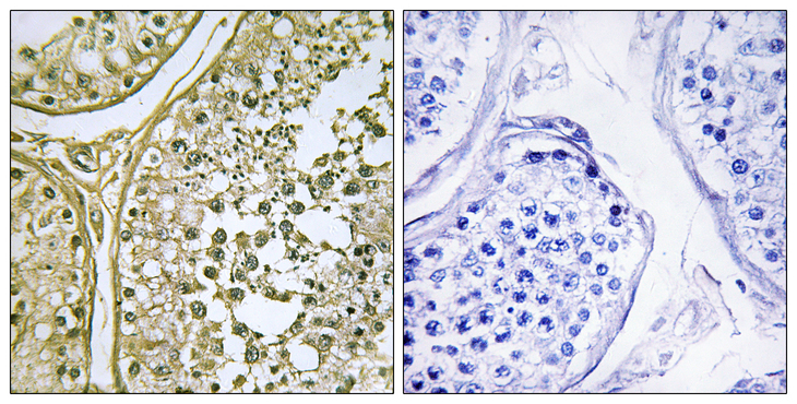 CSNK1A1 + CSNK1A1L Antibody - Immunohistochemistry analysis of paraffin-embedded human testis tissue, using CKI-alpha1/L Antibody. The picture on the right is blocked with the synthesized peptide.