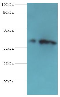 CSNK1A1L Antibody - Western blot. All lanes: Casein kinase I isoform alpha-like antibody at 4 ug/ml. Lane 1: K562 whole cell lysate. Lane 2: HeLa whole cell lysate. Secondary antibody: Goat polyclonal to rabbit at 1:10000 dilution. Predicted band size: 39 kDa. Observed band size: 39 kDa Immunohistochemistry.
