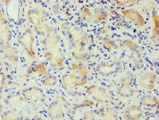 CSNK1A1L Antibody - Immunohistochemistry of paraffin-embedded human kidney using antibody at 1:100 dilution.