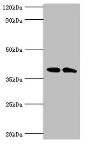 CSNK1A1L Antibody - Western blot All lanes: Casein kinase I isoform alpha-like antibody at 4µg/ml Lane 1: K562 whole cell lysate Lane 2: Hela whole cell lysate Secondary Goat polyclonal to rabbit IgG at 1/10000 dilution Predicted band size: 39 kDa Observed band size: 39 kDa
