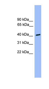 CSNK1A1L Antibody - CSNK1A1L antibody Western blot of 721_B cell lysate. This image was taken for the unconjugated form of this product. Other forms have not been tested.
