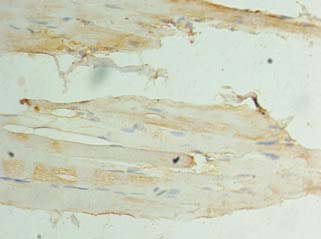 CSNK1D Antibody - Immunohistochemistry of paraffin-embedded human Skeletal muscle using antibody at dilution of 1:100.