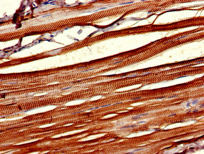 CSNK1D Antibody - IHC image of CSNK1D Antibody diluted at 1:1000 and staining in paraffin-embedded human skeletal muscle tissue performed on a Leica BondTM system. After dewaxing and hydration, antigen retrieval was mediated by high pressure in a citrate buffer (pH 6.0). Section was blocked with 10% normal goat serum 30min at RT. Then primary antibody (1% BSA) was incubated at 4°C overnight. The primary is detected by a biotinylated secondary antibody and visualized using an HRP conjugated SP system.