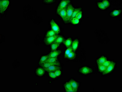 CSNK1D Antibody - Immunofluorescence staining of HepG2 cells with CSNK1D Antibody at 1:333, counter-stained with DAPI. The cells were fixed in 4% formaldehyde, permeabilized using 0.2% Triton X-100 and blocked in 10% normal Goat Serum. The cells were then incubated with the antibody overnight at 4°C. The secondary antibody was Alexa Fluor 488-congugated AffiniPure Goat Anti-Rabbit IgG(H+L).