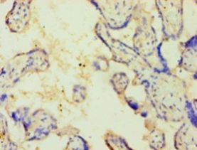 CSNK1E / CK1 Epsilon Antibody - Immunohistochemistry of paraffin-embedded human placenta tissue using antibody at 1:100 dilution.  This image was taken for the unconjugated form of this product. Other forms have not been tested.