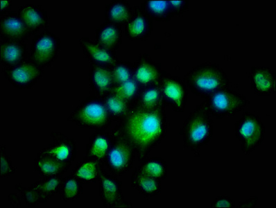 CSNK1E / CK1 Epsilon Antibody - Immunofluorescence staining of Hela cells with CSNK1E Antibody at 1:266, counter-stained with DAPI. The cells were fixed in 4% formaldehyde, permeabilized using 0.2% Triton X-100 and blocked in 10% normal Goat Serum. The cells were then incubated with the antibody overnight at 4°C. The secondary antibody was Alexa Fluor 488-congugated AffiniPure Goat Anti-Rabbit IgG(H+L).