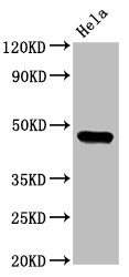 CSNK1E / CK1 Epsilon Antibody - Western Blot Positive WB detected in: Hela whole cell lysate All lanes: CSNK1E antibody at 3.2µg/ml Secondary Goat polyclonal to rabbit IgG at 1/50000 dilution Predicted band size: 48 kDa Observed band size: 48 kDa