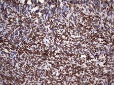 CSNK1E / CK1 Epsilon Antibody - IHC of paraffin-embedded Human Ovary tissue using anti-CSNK1E mouse monoclonal antibody. (Heat-induced epitope retrieval by 1 mM EDTA in 10mM Tris, pH8.5, 120°C for 3min).