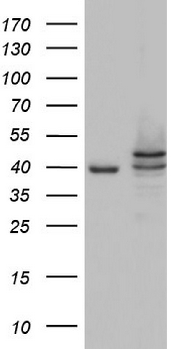 CSNK1E / CK1 Epsilon Antibody - HEK293T cells were transfected with the pCMV6-ENTRY control (Left lane) or pCMV6-ENTRY CSNK1E (Right lane) cDNA for 48 hrs and lysed. Equivalent amounts of cell lysates (5 ug per lane) were separated by SDS-PAGE and immunoblotted with anti-CSNK1E.