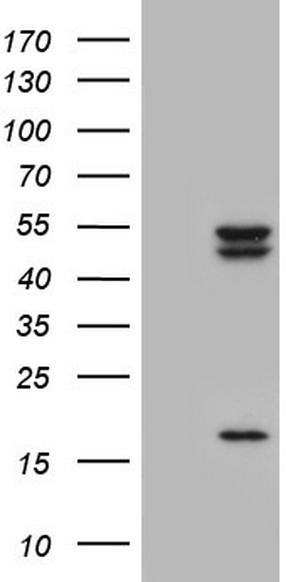 CSNK1E / CK1 Epsilon Antibody - HEK293T cells were transfected with the pCMV6-ENTRY control (Left lane) or pCMV6-ENTRY CSNK1E (Right lane) cDNA for 48 hrs and lysed. Equivalent amounts of cell lysates (5 ug per lane) were separated by SDS-PAGE and immunoblotted with anti-CSNK1E.