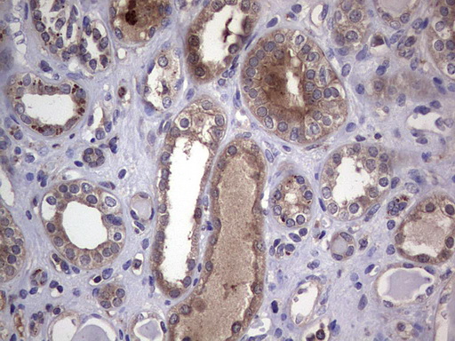 CSNK1E / CK1 Epsilon Antibody - IHC of paraffin-embedded Human Kidney tissue using anti-CSNK1E mouse monoclonal antibody. (Heat-induced epitope retrieval by 1 mM EDTA in 10mM Tris, pH8.5, 120°C for 3min).