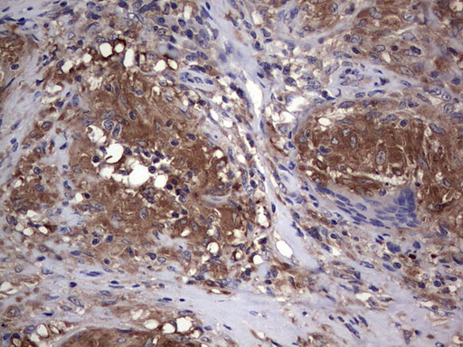 CSNK1E / CK1 Epsilon Antibody - IHC of paraffin-embedded Human lymph node tissue using anti-CSNK1E mouse monoclonal antibody. (Heat-induced epitope retrieval by 1 mM EDTA in 10mM Tris, pH8.5, 120°C for 3min).