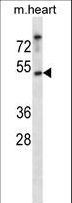 CSNK1E / CK1 Epsilon Antibody - Mouse Csnk1e Antibody western blot of mouse heart tissue lysates (35 ug/lane). The Csnk1e antibody detected the Csnk1e protein (arrow).