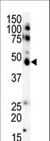 CSNK1E / CK1 Epsilon Antibody - Western blot of anti-CK1e C-term antibody in SKBR3 cell lysate. CK1e (arrow) was detected using purified antibody. Secondary HRP-anti-rabbit was used for signal visualization with chemiluminescence.