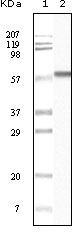 CSNK1E / CK1 Epsilon Antibody - Western blot using CK1 mouse monoclonal antibody against truncated CK1 recombinant protein.
