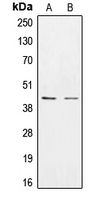 CSNK1E / CK1 Epsilon Antibody - Western blot analysis of CK1 epsilon expression in HEK293T (A); SKBR3 (B) whole cell lysates.